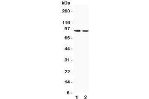 Western blot testing of SLC9A2 antibody and Lane 1:  rat skeletal musle;  2: rat kidney tissue lysate. (SLC9A2 抗体  (C-Term))