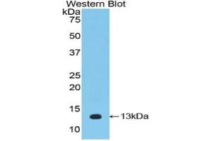 WB of Protein Standard: different control antibodies against Highly purified E. (IL-33 ELISA 试剂盒)