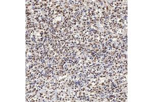 IHC analysis of U1A/SNRPA using anti-U1A/SNRPA antibody (ABIN7600891). (SNRPA1 抗体  (AA 25-218))