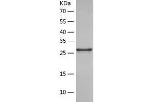 MRP1 Protein (AA 1248-1531) (His tag)