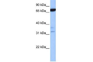 WB Suggested Anti-ZBTB46 Antibody Titration:  0. (ZBTB46 抗体  (N-Term))