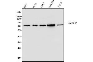 Western blot analysis of MECP2 using anti-MECP2 antibody (ABIN7599805).