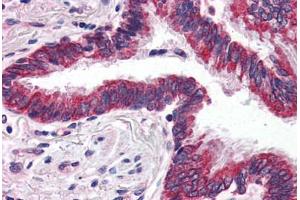 Human Lung (formalin-fixed, paraffin-embedded) stained with GRIK1 antibody ABIN343897 at 5 ug/ml followed by biotinylated goat anti-rabbit IgG secondary antibody ABIN481713, alkaline phosphatase-streptavidin and chromogen. (GRIK1 抗体  (C-Term))