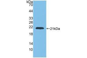Western blot analysis of recombinant Rat GaA. (GAA 抗体  (AA 70-225))