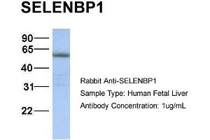 WB Suggested Anti-SELENBP1 antibody Titration: 1 ug/mL Sample Type: Human liver (SELENBP1 抗体  (N-Term))