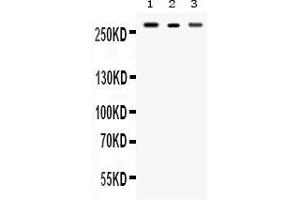 Western blot analysis of Talin 2 expression in rat brain extract ( Lane 1), mouse cardiac muscle extract ( Lane 2) and SMMC7721 whole cell lysates ( Lane 3). (TLN2 抗体  (Middle Region))