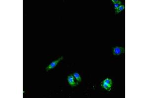 Immunofluorescent analysis of HepG2 cells using ABIN7162688 at dilution of 1:100 and Alexa Fluor 488-congugated AffiniPure Goat Anti-Rabbit IgG(H+L) (PNPLA1 抗体  (AA 101-300))