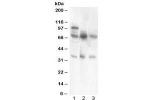 Western blot testing of GAD67 antibody and Lane 1:  rat brain (GAD 抗体  (AA 14-122))