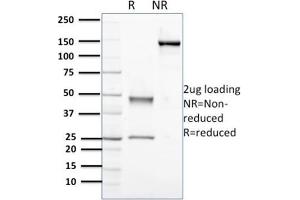 Purified Nucleophosmin-Monospecific Mouse Monoclonal Antibody (NPM1/3398). (NPM1 抗体  (AA 185-287))