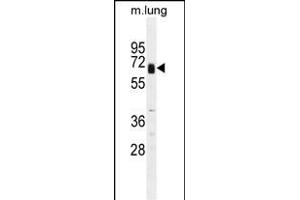 GPC3 Antibody? (Glypican 3 抗体  (C-Term))