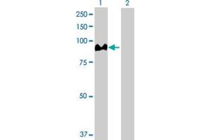 Western Blot analysis of ACO1 expression in transfected 293T cell line by ACO1 MaxPab polyclonal antibody. (Aconitase 1 抗体  (AA 1-889))