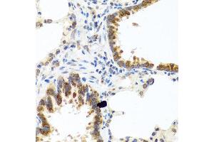 Immunohistochemistry of paraffin-embedded rat lung using C8orf4 antibody at dilution of 1:100 (40x lens). (C8orf4 抗体)