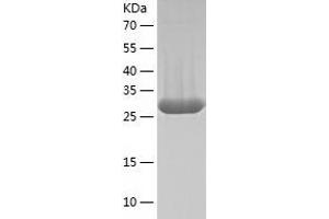 Western Blotting (WB) image for Carbonic Anhydrase XIV (CA14) (AA 16-290) protein (His tag) (ABIN7122135) (CA14 Protein (AA 16-290) (His tag))