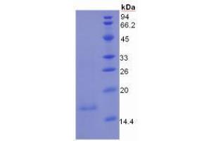 SDS-PAGE analysis of Human Mucin 5B Protein. (MUC5B 蛋白)