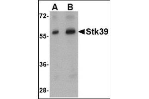 Western blot analysis of Stk39 in rat brain tissue lysate with this product at (A) 1 and (B) 2 μg/ml. (STK39 抗体  (Center))