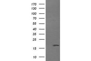 Image no. 1 for anti-Cancer/testis Antigen 1B (CTAG1B) antibody (ABIN1499902) (CTAG1B 抗体)