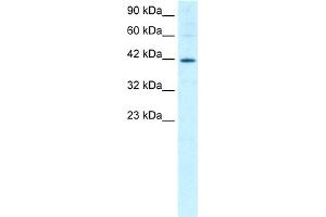 WB Suggested Anti-MIER1 Antibody Titration:  1. (MIER1 抗体  (Middle Region))