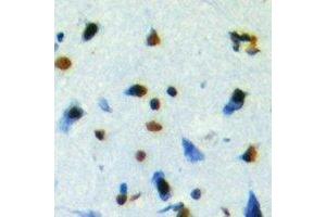 Immunohistochemistry (IHC) image for anti-NUDC antibody (ABIN7308104) (NUDC 抗体)