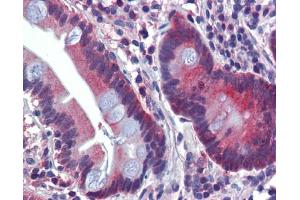 Immunohistochemistry (IHC) image for anti-ATPase, H+ Transporting, Lysosomal V0 Subunit A2 (ATP6V0A2) (N-Term) antibody (ABIN634572)