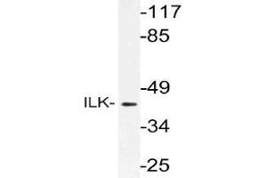 Western blot (WB) analysis of ILK antibody in extracts from rat liver cells. (ILK 抗体)