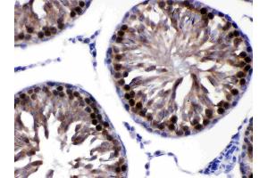 CACYBP was detected in paraffin-embedded sections of rat testis tissues using rabbit anti- CACYBP Antigen Affinity purified polyclonal antibody (Catalog # ) at 1 µg/mL. (CACYBP 抗体  (N-Term))