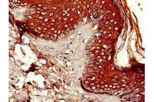 IHC analysis of paraffin-embedded human skin tissue, using P4HA1 antibody (1/100 dilution). (P4HA1 抗体  (AA 256-525))