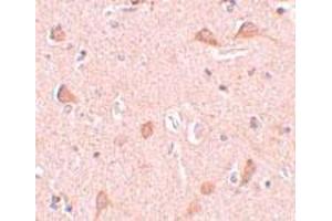 Immunohistochemical staining of human brain tissue with 5 ug/mL SIPA1L1 polyclonal antibody . (SIPA1L1 抗体  (N-Term))