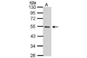 WB Image Sample (30 ug of whole cell lysate) A: Hela S3 10% SDS PAGE antibody diluted at 1:1000 (STK25 抗体)
