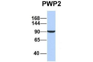 Host:  Rabbit  Target Name:  PWP2  Sample Type:  MCF7  Antibody Dilution:  1. (PWP2 抗体  (Middle Region))