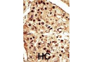 Immunohistochemistry (IHC) image for anti-Transient Receptor Potential Cation Channel, Subfamily M, Member 7 (TRPM7) antibody (ABIN2995271) (TRPM7 抗体)