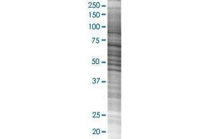 CCT8L2 transfected lysate. (CESK1 293T Cell Transient Overexpression Lysate(Denatured))
