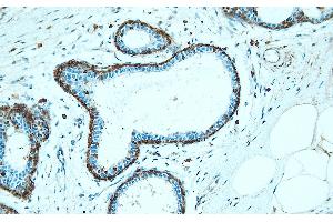 Immunohistochemistry (IHC) image for anti-Annexin A1 (ANXA1) (AA 149-166), (Internal Region) antibody (ABIN7598902)
