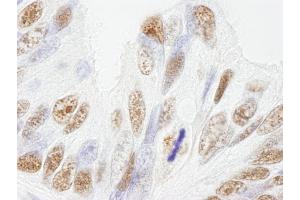 Immunohistochemistry (IHC) image for anti-Nuclear Mitotic Apparatus Protein 1 (NUMA1) (AA 900-950) antibody (ABIN7448994) (NUMA1 抗体  (AA 900-950))
