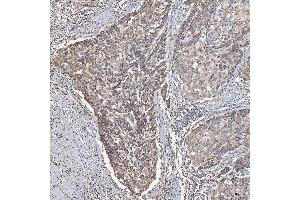 IHC analysis of ACAD9 using anti-ACAD9 antibody (ABIN7602670).