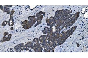 IHC analysis of MAP4K5 using anti-MAP4K5 antibody (ABIN7603181).