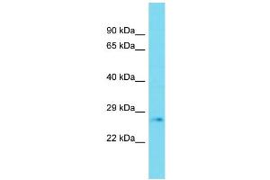 Host: Rabbit Target Name: PLD6 Sample Type: Fetal Heart lysates Antibody Dilution: 1. (PLD6 抗体  (C-Term))