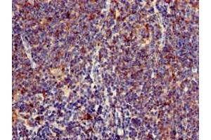Immunohistochemistry of paraffin-embedded human lymph node tissue using ABIN7158646 at dilution of 1:100 (BC055111 抗体  (AA 1-418))