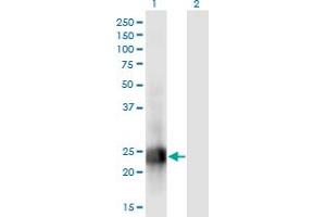 Western Blot analysis of MID1IP1 expression in transfected 293T cell line by MID1IP1 monoclonal antibody (M01), clone 8G8. (m1ip1 抗体  (AA 1-183))