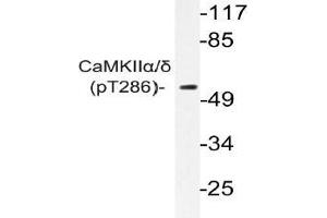 Western blot (WB) analyzes of p-CaMKIIalpha/delta antibody in extracts from K562 cells. (CAMK2A 抗体  (pThr286))