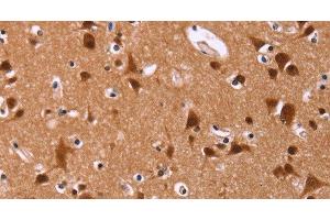 Immunohistochemistry of paraffin-embedded Human brain tissue using ART5 Polyclonal Antibody at dilution 1:50 (ART5 抗体)