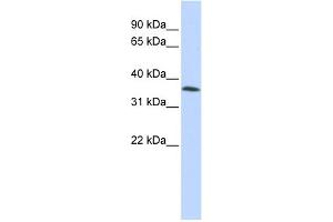 WB Suggested Anti-C8orf70 Antibody Titration:  0. (FAM164A 抗体  (Middle Region))