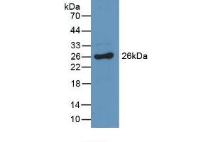 Detection of Recombinant GSTa3, Mouse using Polyclonal Antibody to Glutathione S Transferase Alpha 3 (GSTa3) (GSTA3 抗体  (AA 1-221))