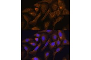 Immunohistochemistry of paraffin-embedded mouse kidney using SHMT1 antibody (ABIN6132654, ABIN6147744, ABIN6147746 and ABIN6216135) at dilution of 1:100 (40x lens). (SHMT1 抗体  (AA 285-444))