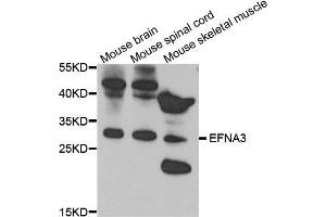 Western Blotting (WB) image for anti-Ephrin A3 (EFNA3) (AA 23-214) antibody (ABIN3016534) (Ephrin A3 抗体  (AA 23-214))