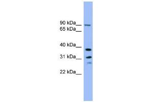 WB Suggested Anti-LHPP Antibody Titration: 0. (LHPP 抗体  (Middle Region))
