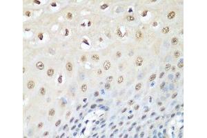 Immunohistochemistry of paraffin-embedded Human esophagus using VCP Polyclonal Antibody at dilution of 1:200 (40x lens). (VCP 抗体)