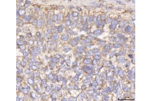 IHC analysis of DLST using anti-DLST antibody (ABIN7599412). (DLST 抗体  (AA 1-453))