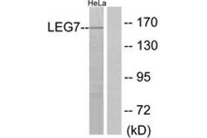 Western blot analysis of extracts from HeLa cells, using LEG7 Antibody. (LGALS7 抗体  (AA 41-90))