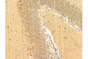 Phospho-EPRS (Ser886) Antibody at 1/100 staining Rat brain tissue by IHC-P. (EPRS 抗体  (pSer886))