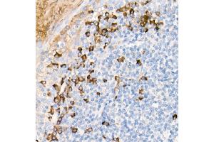 Immunohistochemistry of paraffin-embedded Human tonsil using Human IgG antibody (ABIN7267844) at dilution of 1:300 (40x lens). (IGHG1 抗体)